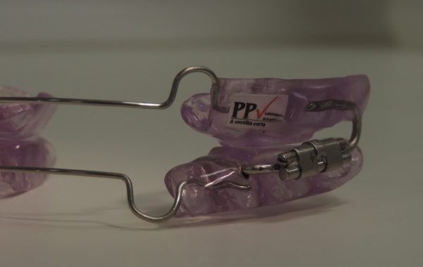 PPV 2 em resina – microexpansor