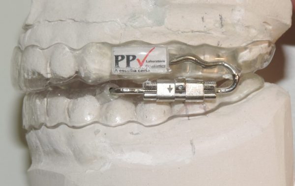 PPV 2 em acetato – microexpansor